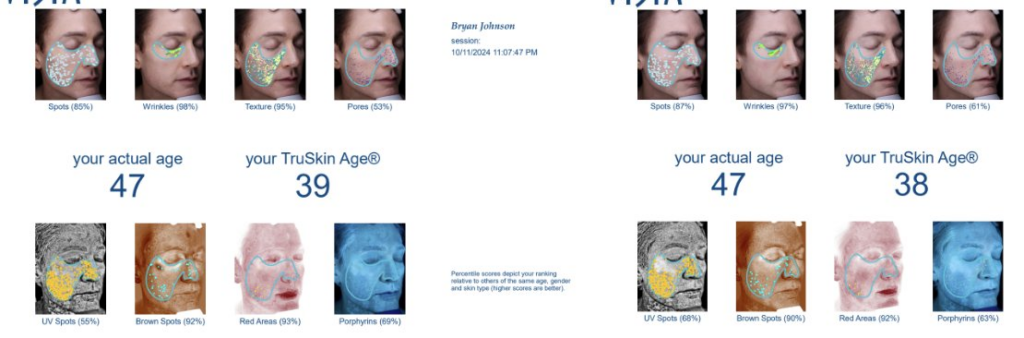 Bryan Johnson facial skin age before and after HBOT
